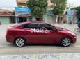 Hyundai Accent 330tr 2017 - 330tr