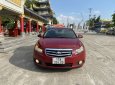 Daewoo Lacetti 2009 - Thân vỏ keo chỉ cột kèo zin 